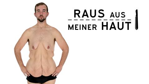 Raus aus meiner Haut