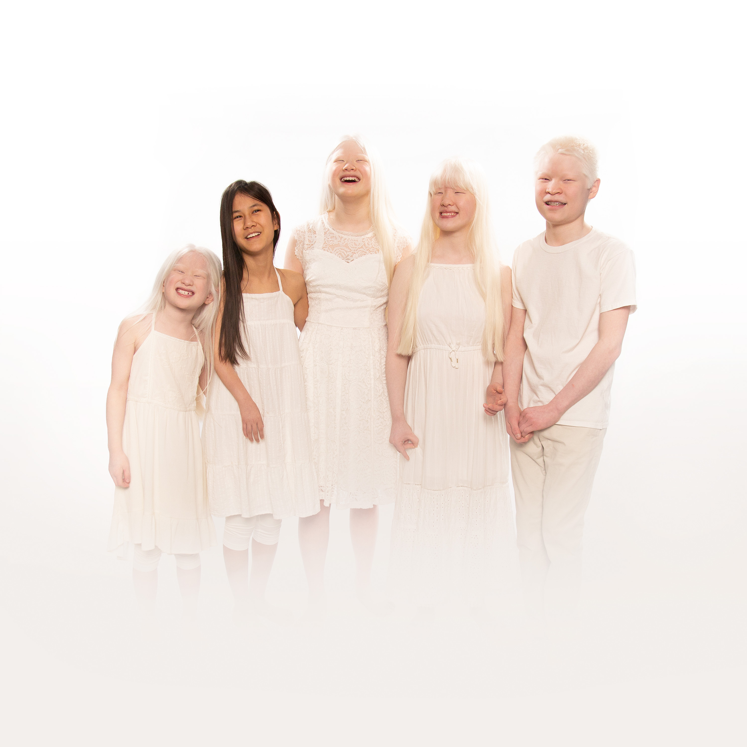 Born With Albinism | Shows | discovery+