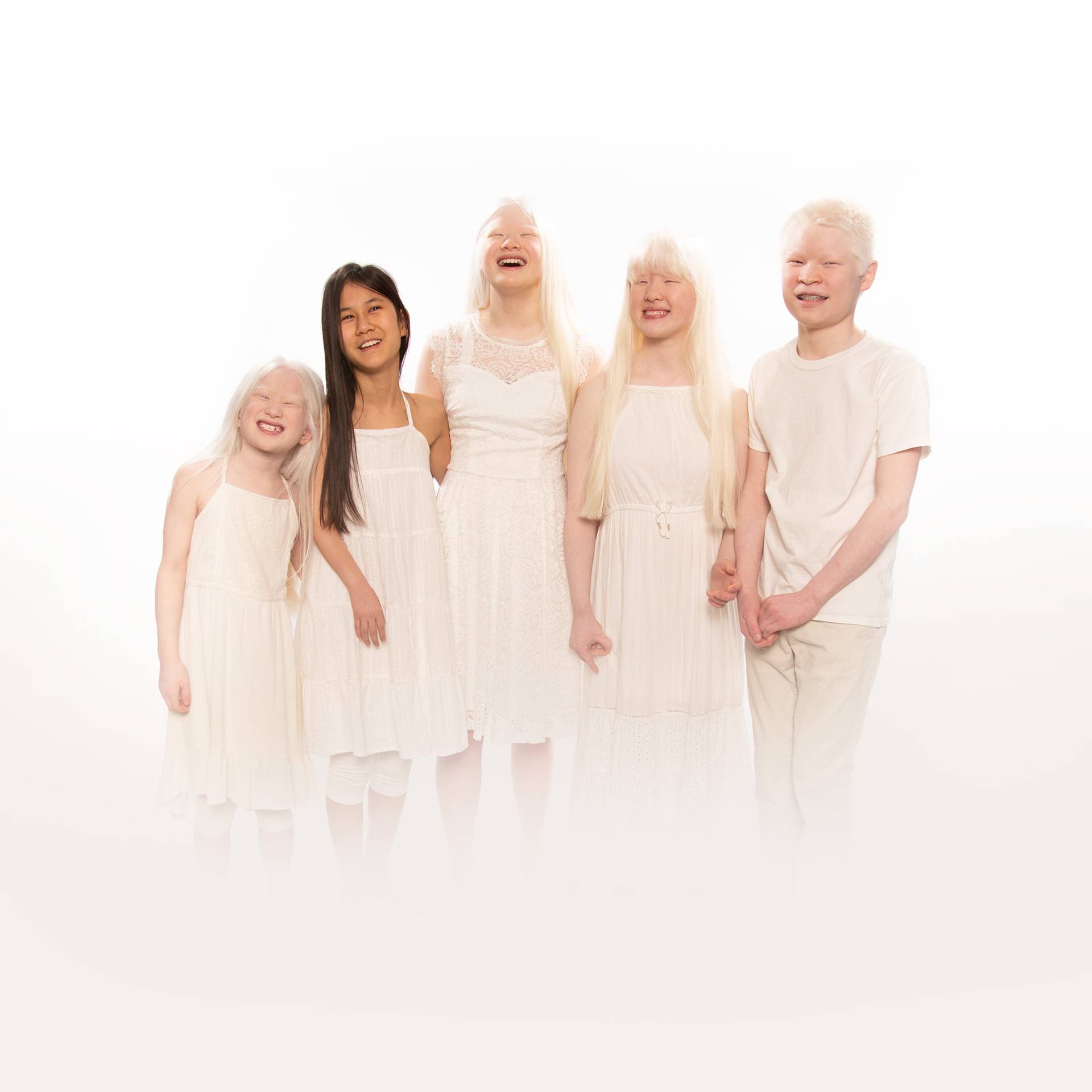 Born With Albinism | Shows | discovery+